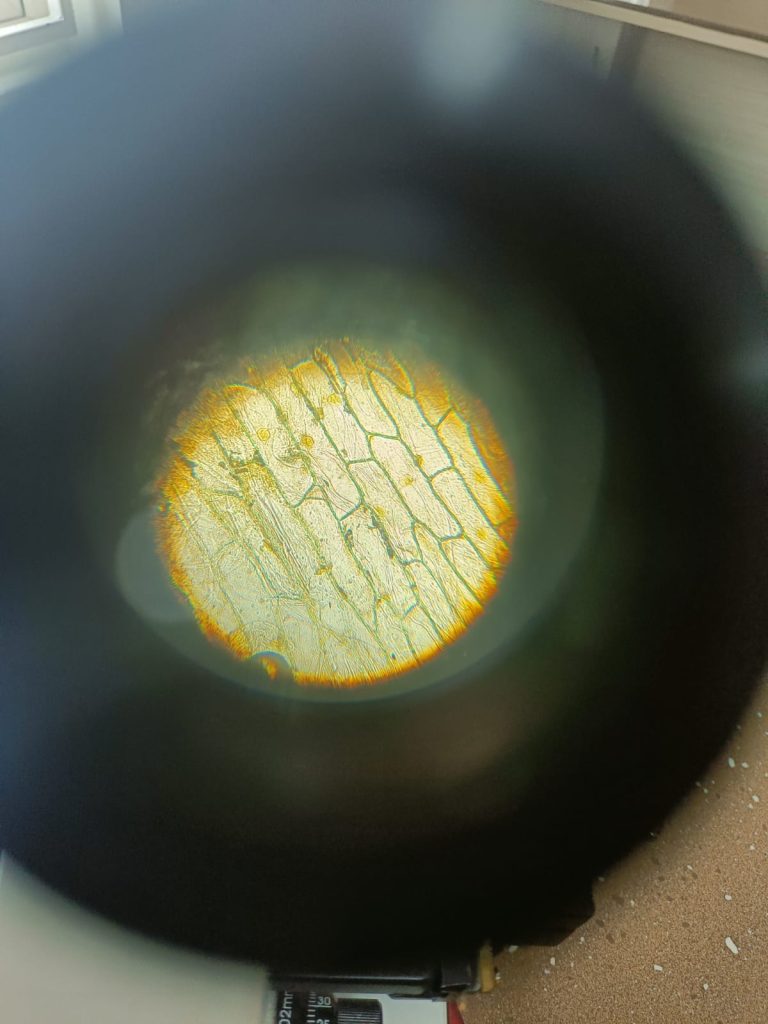 Observing the plant cell onion cell cpsgs ann cps global